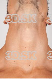 Neck texture of Lukas 0001